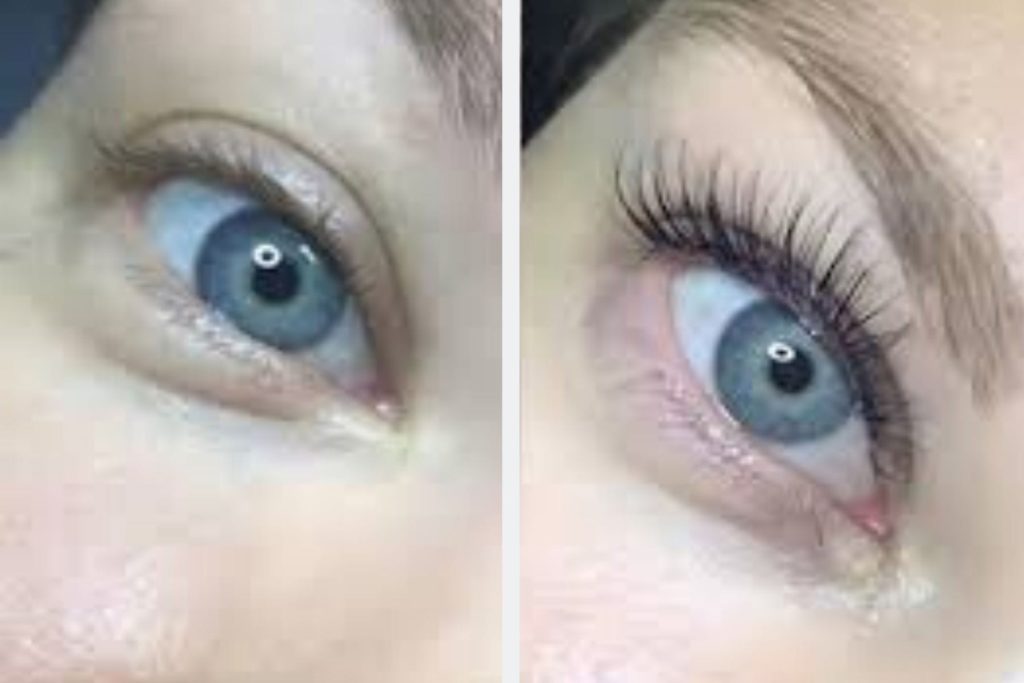 Lash Botox