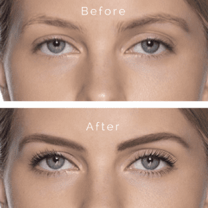Before and after elleebana